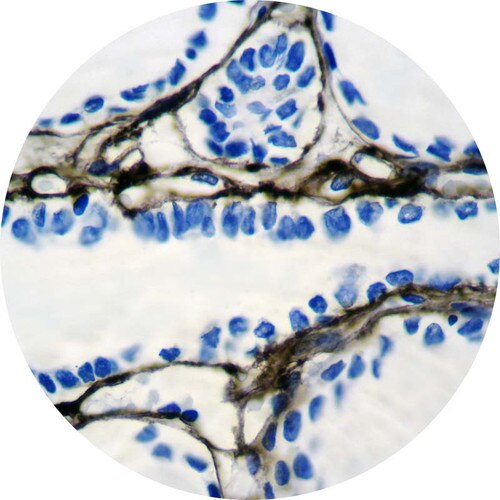 IHC of Collagen Type IV on an FFPE Skin Tissue